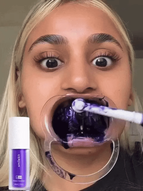 Blanqueador Dental V34™ - TRENDFINDER® (2024) ⭐⭐⭐⭐⭐