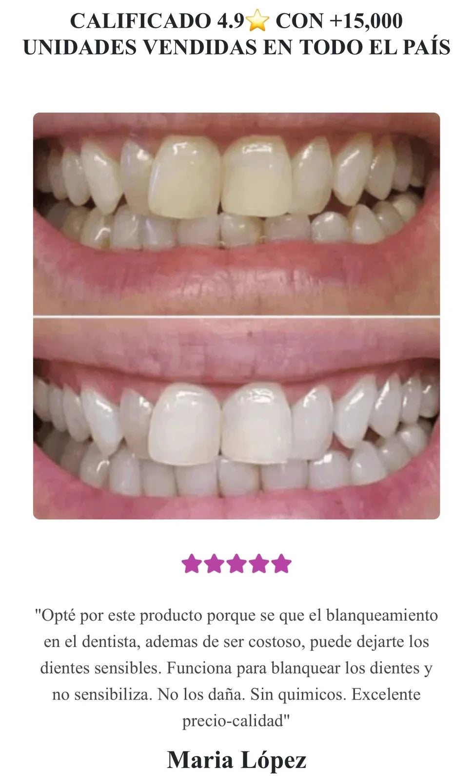 Blanqueador Dental V34™ - TRENDFINDER® (2024) ⭐⭐⭐⭐⭐