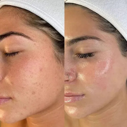 🌸 Elixir Revitalizante LABIF Skincare – Piel Radiante en Cada Gota 🌸