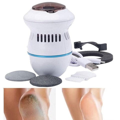 🦶💫Removedor De Callos Electrico SoftStep✨ Suavidad en cada paso que das🦶💫