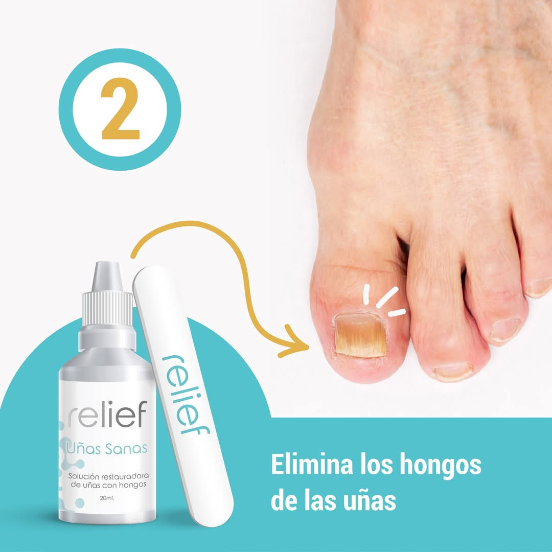 ✨💅RELIEF✨💅 Fungicida para Hongos en las Uñas✨💅